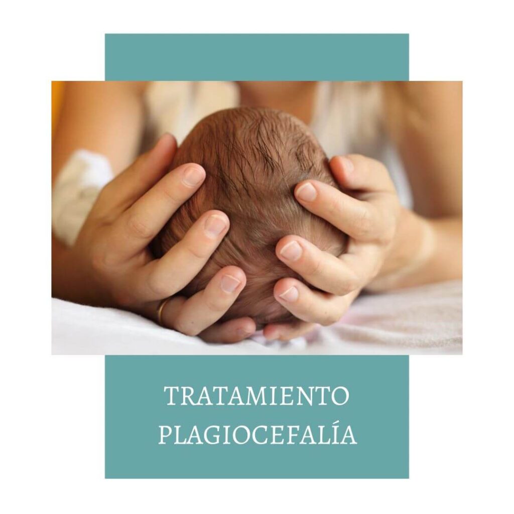 tratamiento de Plagiocefalia